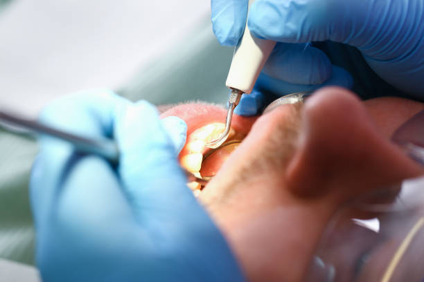 Best Orthodontic Emergency Dentist in La Vernia, TX