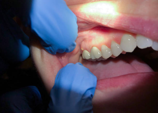 Best Orthodontic Emergency Dentist in La Vernia, TX