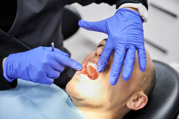 Best Emergency Root Canal Treatment in La Vernia, TX